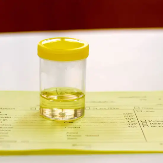 bismuth random urine test